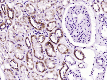 SOD2 Mouse Monoclonal Antibody