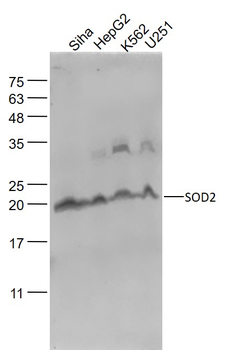 SOD2 Mouse Monoclonal Antibody