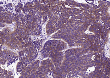 FASN Mouse Monoclonal Antibody