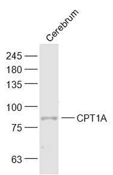 CPT1A Rabbit Polyclonal Antibody
