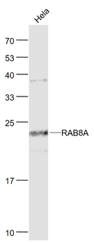 RAB8A Mouse Monoclonal Antibody