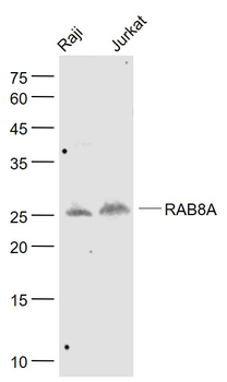 RAB8A Mouse Monoclonal Antibody