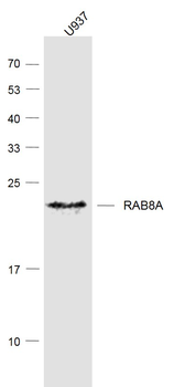 RAB8A Mouse Monoclonal Antibody
