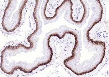 Collagen XVII Recombinant Rabbit Monoclonal Antibody