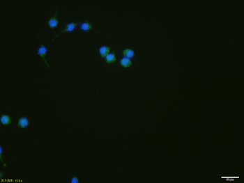 Smad3 Recombinant Rabbit Monoclonal Antibody