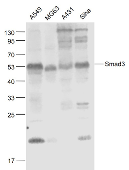 Smad3 Recombinant Rabbit Monoclonal Antibody