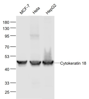 CK18 Recombinant Rabbit Monoclonal Antibody