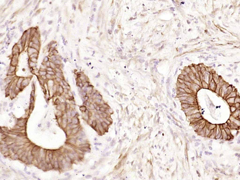 CK18 Recombinant Rabbit Monoclonal Antibody