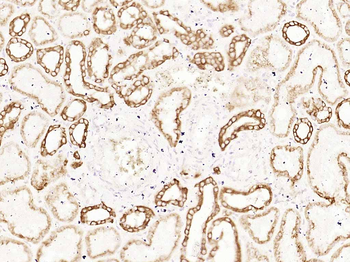 CK18 Recombinant Rabbit Monoclonal Antibody