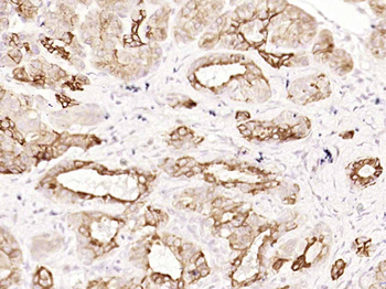 CK18 Recombinant Rabbit Monoclonal Antibody