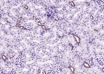 CK18 Recombinant Rabbit Monoclonal Antibody