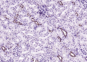 Cytokeratin 18 antibody