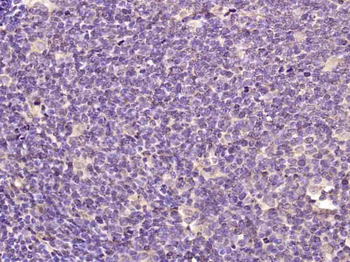 RUNX1 / AML1 + RUNX3 + RUNX2 Rabbit Polyclonal Antibody