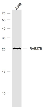 RAB27B Mouse Monoclonal Antibody