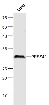 PRSS42 Rabbit Polyclonal Antibody