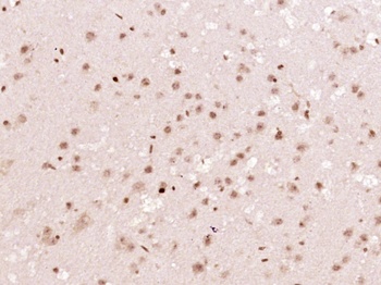 p38 MAPK (phospho-Tyr323) antibody