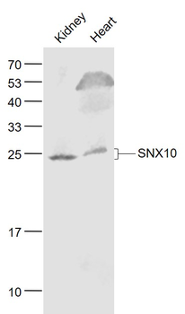 SNX10 Rabbit Polyclonal Antibody