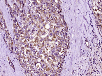 C1 Inactivator Rabbit Polyclonal Antibody