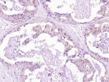 Dnmt1 Rabbit Polyclonal Antibody