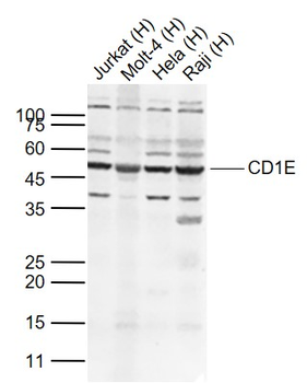 CD1E Rabbit Polyclonal Antibody