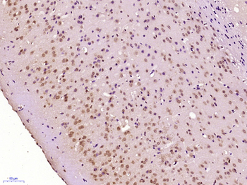 RBM11 Rabbit Polyclonal Antibody