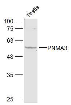 PNMA3 Rabbit Polyclonal Antibody