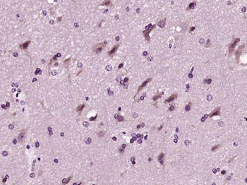 PALB2 Rabbit Polyclonal Antibody