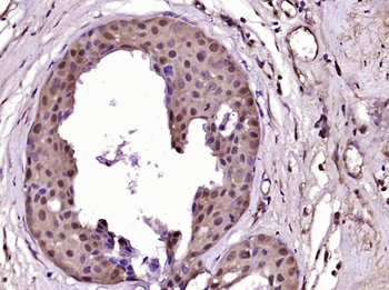 PALB2 Rabbit Polyclonal Antibody
