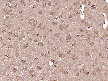 ATG7/APG7 Mouse Monoclonal Antibody