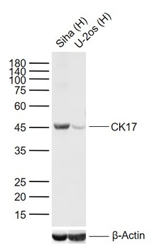 CK17 antibody