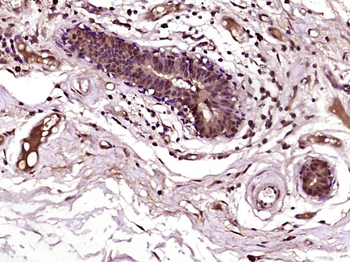 RAF1 Rabbit Polyclonal Antibody