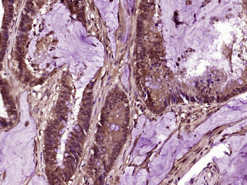 RAF1 Rabbit Polyclonal Antibody