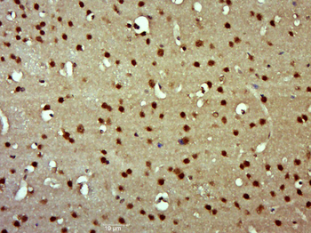 RAF1 Rabbit Polyclonal Antibody