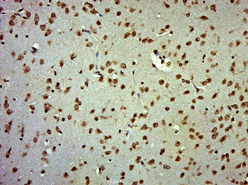 RAF1 Rabbit Polyclonal Antibody