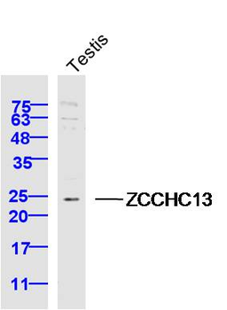 ZCCHC13 Rabbit Polyclonal Antibody