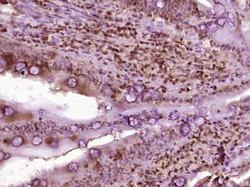 Beta catenin Rabbit Polyclonal Antibody