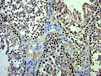 CENPQ Rabbit Polyclonal Antibody