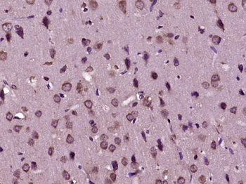 HSP90 beta Rabbit Polyclonal Antibody