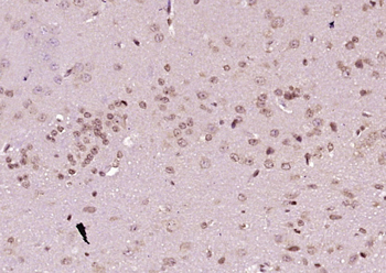 Phospho-SMAD7 (Ser249) Rabbit Polyclonal Antibody