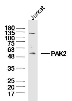 PAK2 Rabbit Polyclonal Antibody