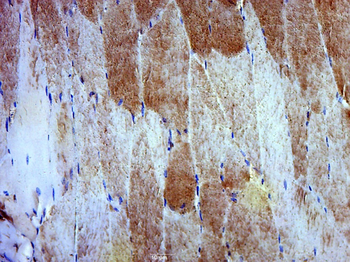 Dystrobrevin alpha Rabbit Polyclonal Antibody