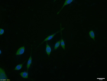 Dystrobrevin alpha Rabbit Polyclonal Antibody