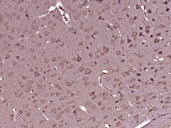 LTBR Rabbit Polyclonal Antibody