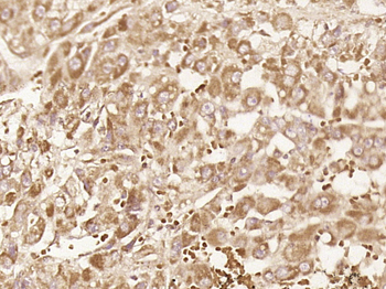 Insulin Lispro Rabbit Polyclonal Antibody