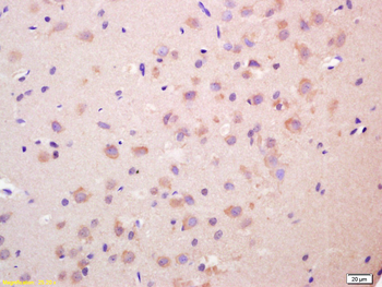 SECTM1 Rabbit Polyclonal Antibody