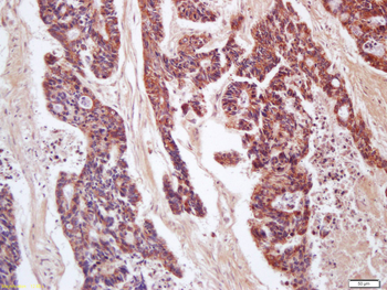 CD200 Rabbit Polyclonal Antibody