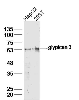Glypican 3 Rabbit Polyclonal Antibody
