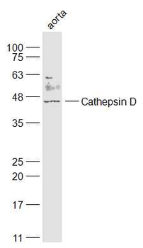 Cathepsin D Rabbit Polyclonal Antibody