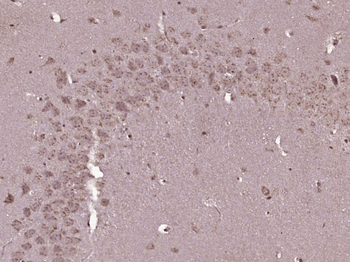 IL-6R alpha Rabbit Polyclonal Antibody