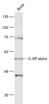 IL-6R alpha Rabbit Polyclonal Antibody